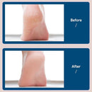 Dead Skin Remover foot hygiene Tool - likeinstore