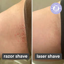 Laser Hair Remover - likeinstore