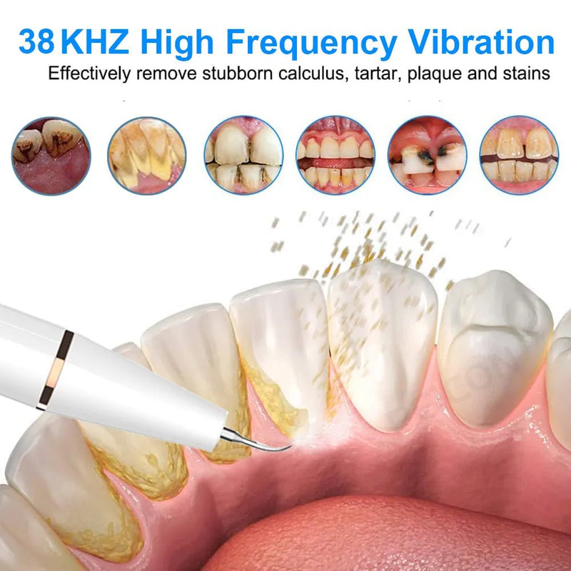 Ultrasonic Dental Scaler For Teeth Tartar - likeinstore