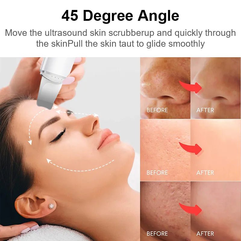Ultrasonic Skin Scrubber Vibration - likeinstore